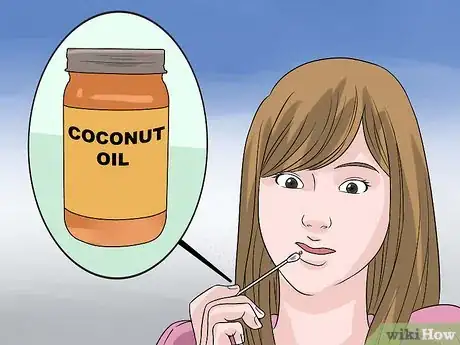 Immagine titolata Stop a Mouth Ulcer from Hurting Step 6
