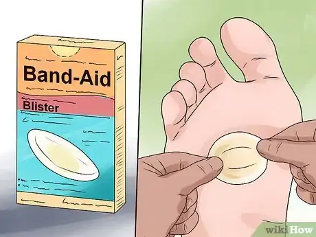 Immagine titolata Care for a Burst Blister Step 7