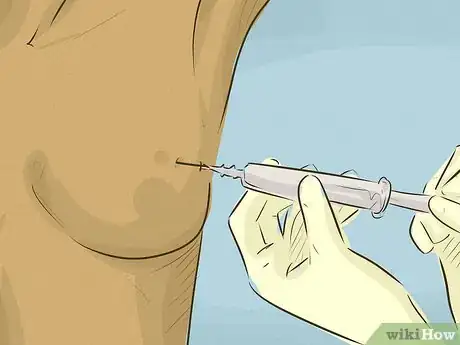 Immagine titolata Identify a Lump in a Breast Step 8