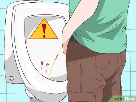 Immagine titolata Know if You Have Epididymitis Step 3