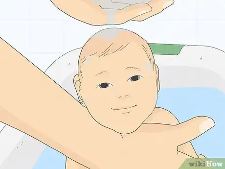 Immagine titolata Treat Baby Heat Rash Step 1