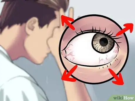 Immagine titolata Wash Eyes With Water Step 18