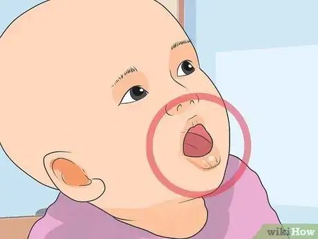 Immagine titolata Prevent Infant Dehydration Step 2