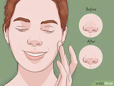 Immagine titolata Close Blackhead Holes Step 6