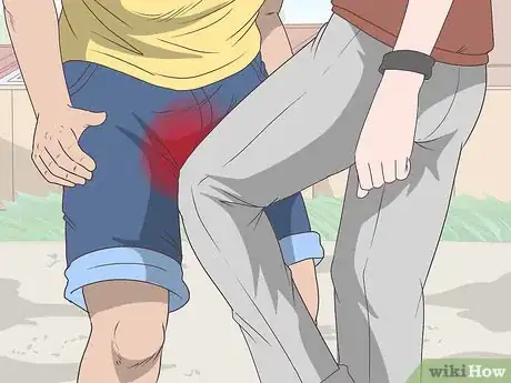Immagine titolata Know if You Have Epididymitis Step 9