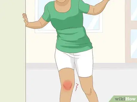 Immagine titolata Heal a Meniscus Tear Step 1