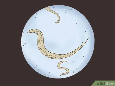 Immagine titolata Recognize and Prevent a Pinworm Infection Step 1