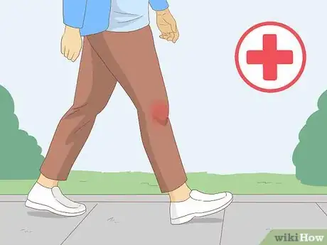 Immagine titolata Heal a Meniscus Tear Step 4
