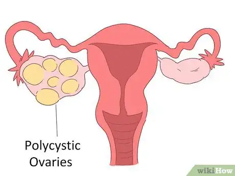 Immagine titolata Lower Testosterone Levels Step 13