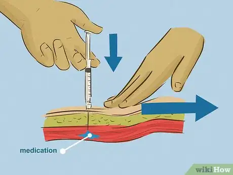 Immagine titolata Give an Intramuscular Injection Step 17