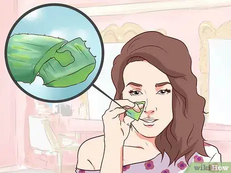 Immagine titolata Get Rid of Pimple Redness Overnight Step 6