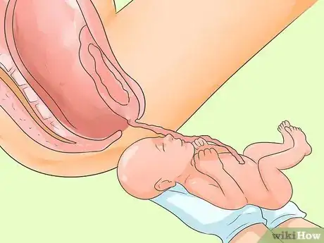 Immagine titolata Deliver a Baby Step 18