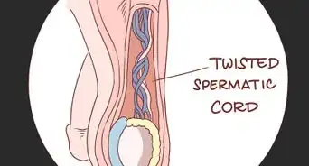 Trattare il Dolore e il Gonfiore ai Testicoli