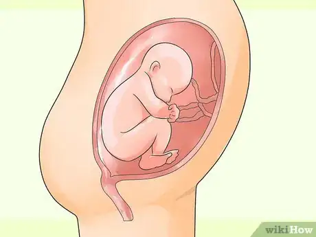 Immagine titolata Deliver a Baby Step 15