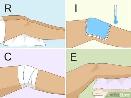 Immagine titolata Heal a Meniscus Tear Step 6