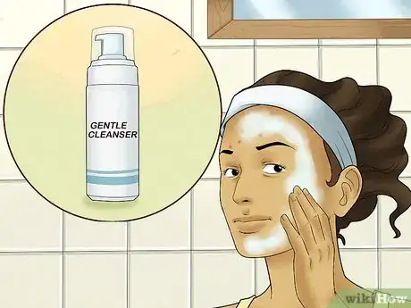 Immagine titolata Get Rid of Forehead Acne Step 14