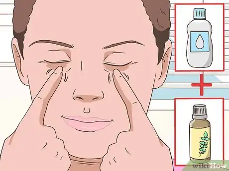 Immagine titolata Use Frankincense Oil Step 5
