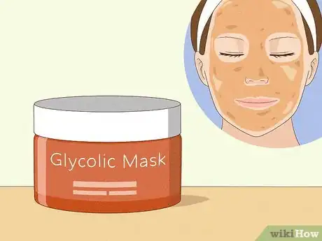 Immagine titolata Reduce the Swelling and Redness of Pimples Step 8