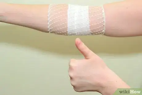 Immagine titolata Strap an Elbow Step 13