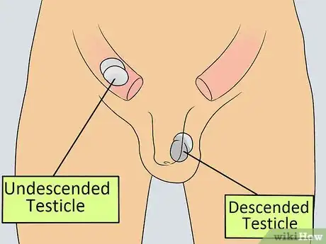 Immagine titolata Recognize Male Infertility Step 14