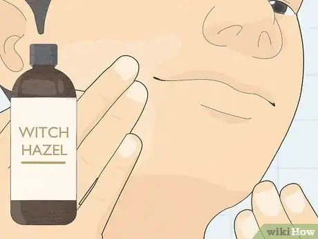 Immagine titolata Care for Your Skin As a Guy Step 11