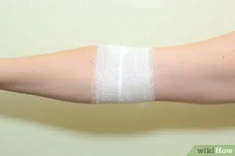 Immagine titolata Strap an Elbow Step 11
