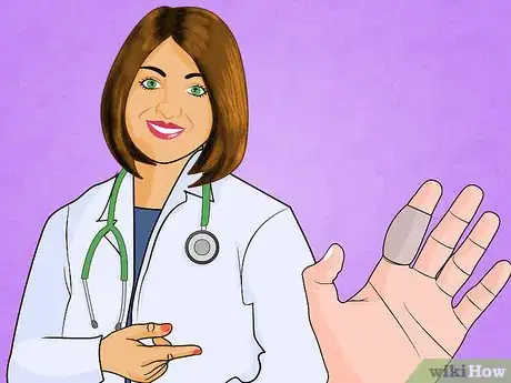 Immagine titolata Treat a Broken Finger Step 10
