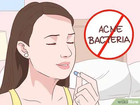 Immagine titolata Treat Acne (Teenage Girls) Step 16