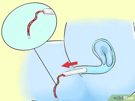 Immagine titolata Remove a Tampon Step 5
