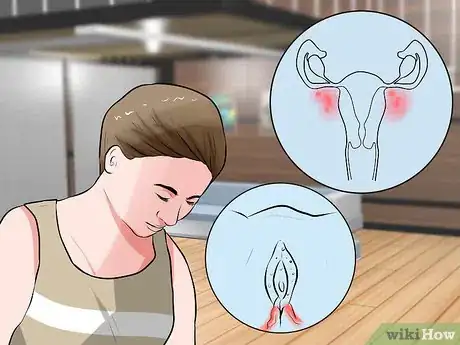 Immagine titolata Recognize Vulva Cancer Symptoms Step 4