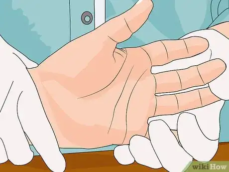 Immagine titolata Treat a Broken Finger Step 16