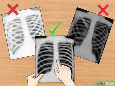 Immagine titolata Read a Chest X Ray Step 5