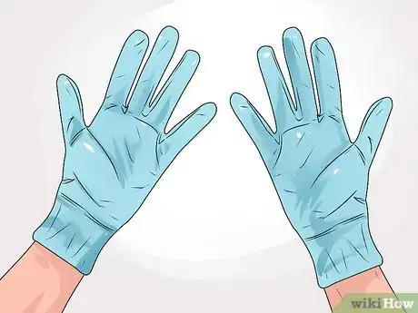 Immagine titolata Care for a Burst Blister Step 16