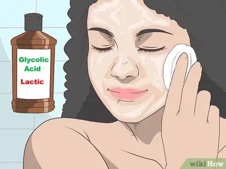 Immagine titolata Get Rid of Milia Step 4