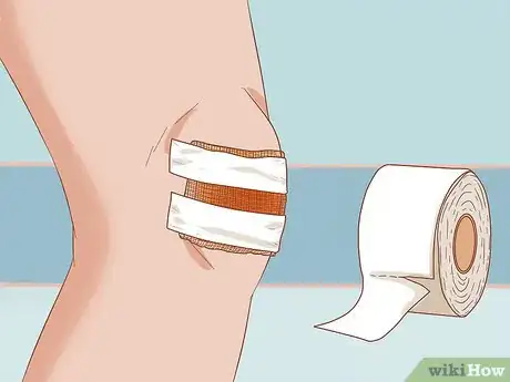 Immagine titolata Apply Different Types of Bandages Step 20