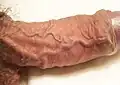 Vene del pene