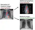 In un derivato di un'immagine medica creata negli Stati Uniti, annotazioni e spiegazioni aggiunte possono essere protette da copyright, ma l'immagine medica stessa rimane di dominio pubblico.