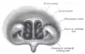 Ricostruzione di reperto di rinoscopia posteriore che permette di individuale il setto e la coda dei turbinati medio ed inferiore.