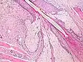 Inserimento di ghiandole sebacee nel fusto pilifero